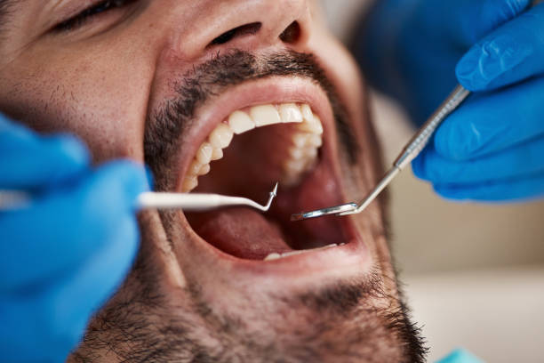 Reliable MO Emergency Dentist Solutions